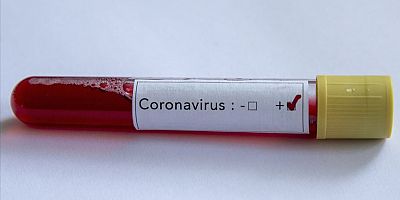 Almanya'da günde 200 bin koronavirüs testi yapılması amaçlanıyor