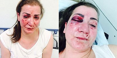Türk kadına tramvayda saldırı