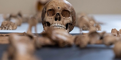 Avustralya’da Şok Skandal: Üniversite 25 Yıl Boyunca İzinsiz Beden Parçaları Toplamış